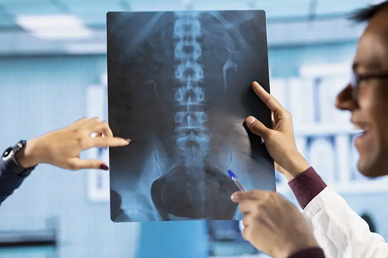 Physician reviewing spinal X-ray to plan minimally invasive spine procedure