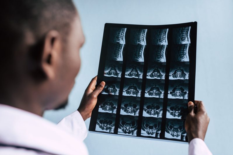 Spine specialist reviewing MRI images with a patient during a second-opinion consultation in New Jersey